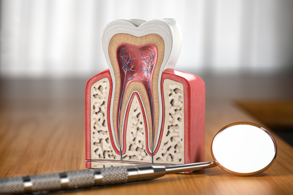 Root Canals  Memphis, TN