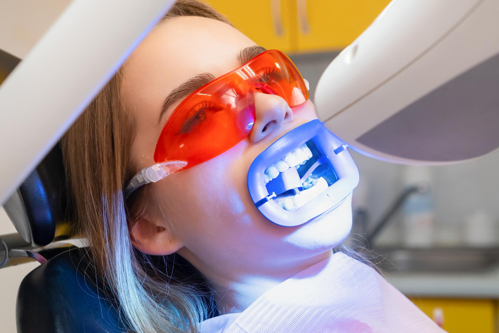 Teeth Whitening Memphis, TN